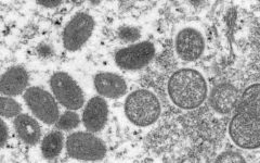 Ukraine on Thursday recorded its first monkeypox case