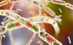 DLS launches emergency measures to prevent anthrax