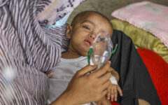 DGHS asks hospitals to increase beds amid measles surge